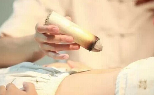 刮痧后可以艾灸嗎？刮痧后注意事項(xiàng)