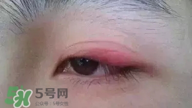 長期用假睫毛雙眼皮貼對眼睛有什么傷害？