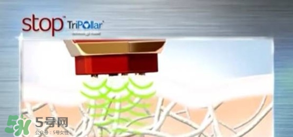 tripollar stop怎么樣？tripollar pose好用嗎