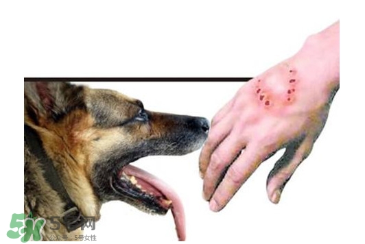 狂犬病會傳染嗎？狂犬病會學(xué)狗叫嗎