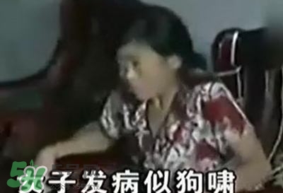 狂犬病能治好嗎？狂犬病的早期癥狀