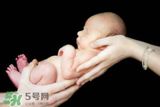 寶寶臍帶掉了要緊嗎？寶寶臍帶掉了出血了怎么辦？