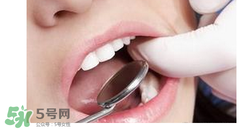 兒童換牙還沒(méi)掉就長(zhǎng)牙正常嗎？?jī)和瘬Q牙先長(zhǎng)牙是為什么？