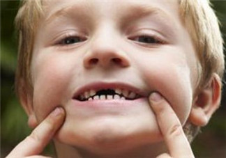 寶寶換牙可以吃糖嗎？小孩換牙期間能不能吃糖？