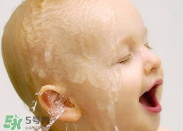 寶寶濕疹可以用金銀花洗臉嗎？金銀花洗臉能治療濕疹嗎？