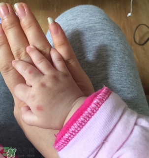 日本叮叮對寶寶有害嗎？日本叮叮驅(qū)蚊劑孕婦可以用嗎