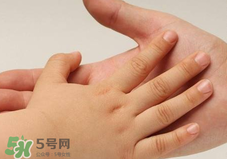 寶寶指甲凹凸不平是什么原因？寶寶指甲凹凸不平正常嗎？