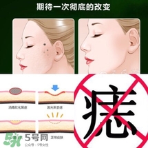 藥水點(diǎn)痣和激光點(diǎn)痣哪個好？各有什么優(yōu)缺點(diǎn)