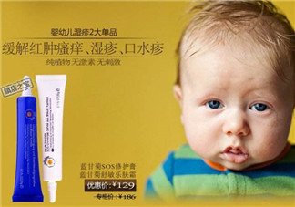 恩姆花園濕疹膏有激素嗎？恩姆花園濕疹膏含不含激素？