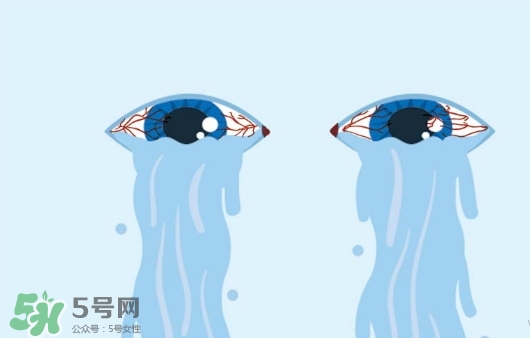 眼藥水可以兩個(gè)人用嗎？眼藥水可以共用嗎？