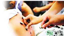 三伏貼要貼幾次？三伏貼要貼多久？