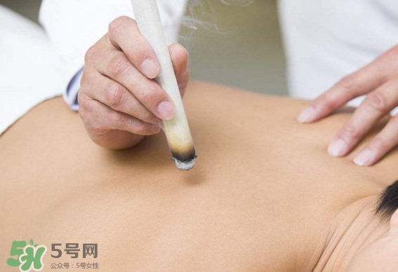 一天中什么時間艾灸好？艾灸什么時間做最好