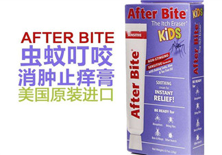 after bite止癢膏好用嗎？after bite止癢膏怎么樣？