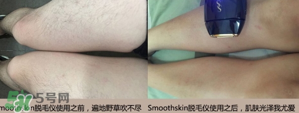 smoothskin和slikn infinity哪個好？smoothskin脫毛儀怎么樣