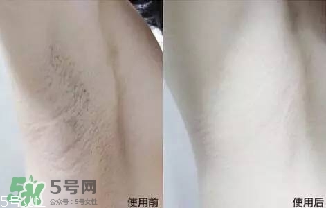 nair脫毛膏評測？nair脫毛膏保質(zhì)期