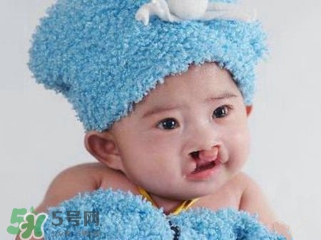 兔唇可以治嗎？兔唇修補(bǔ)術(shù)