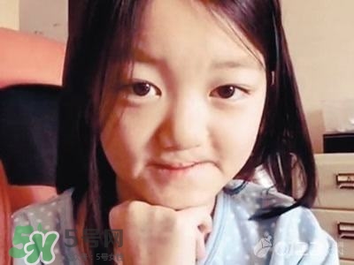 兔唇是什么？兔唇是什么原因造成的？