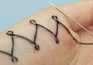 人體刺繡是自殘嗎？人體刺繡有什么危害