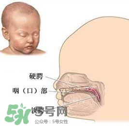 兔唇能檢查出來嗎？兔唇能完全修復(fù)嗎？