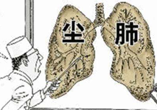 塵肺病能治愈嗎？塵肺病能活多久