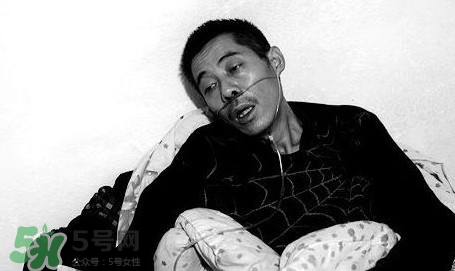 塵肺病能治愈嗎？塵肺病能活多久