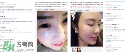 天倍面膜是日本的嗎？日本tenbe天倍面膜騙局