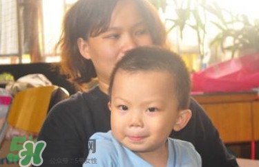 地中海貧血有什么癥狀？地中海貧血能活多久