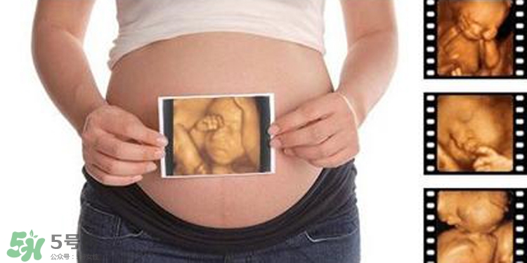 四維彩超有必要做嗎？四維彩超檢查不出什么？