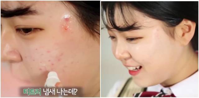 real skin patch怎么樣？real skin是什么牌子