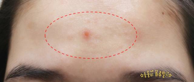 real skin patch怎么樣？real skin是什么牌子