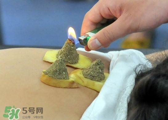 三伏灸灸哪里？三伏灸是每天都灸嗎