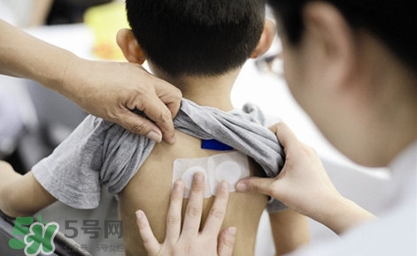 三伏灸有什么作用？三伏灸不能吃什么