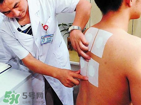 三伏灸可以治療什么??？三伏灸與艾灸有什么區(qū)別