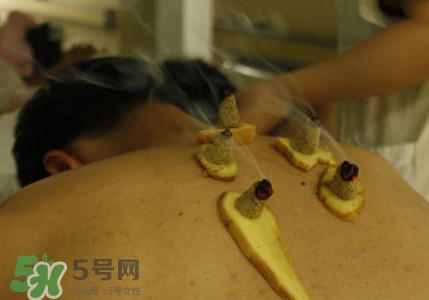 三伏灸有用嗎？2017年三伏艾灸時(shí)間