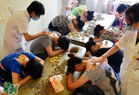 三伏灸有什么作用？三伏灸不能吃什么