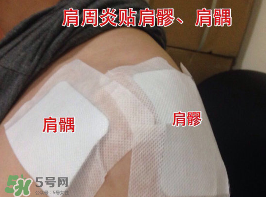 艾灸貼多少錢一盒?？艾灸貼一盒60裝多少錢？