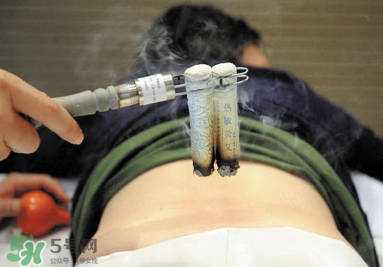 艾灸多少錢一次？艾灸調(diào)理價(jià)目表