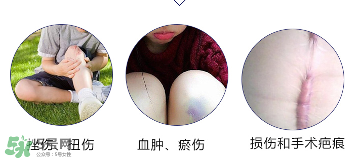 hirudoid除疤膏有效嗎？hirudoid去疤膏效果如何？