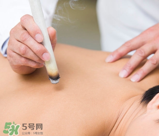 三伏貼和艾灸哪個(gè)好？三伏貼和艾灸區(qū)別