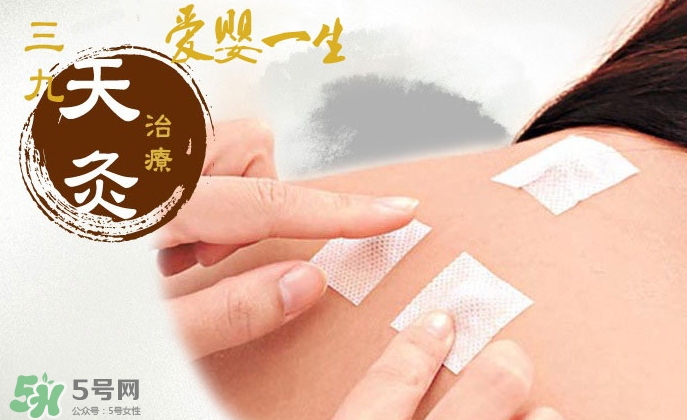 貼三伏貼掛什么科？三伏貼掛什么號？