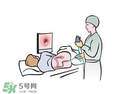 直腸癌怎么查出來的？直腸癌怎么判斷早晚期