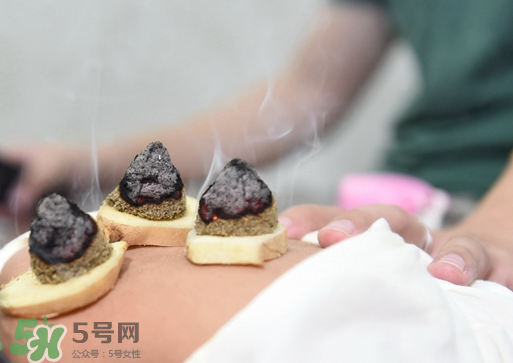 三伏灸什么人不能做？三伏灸適合哪些人？