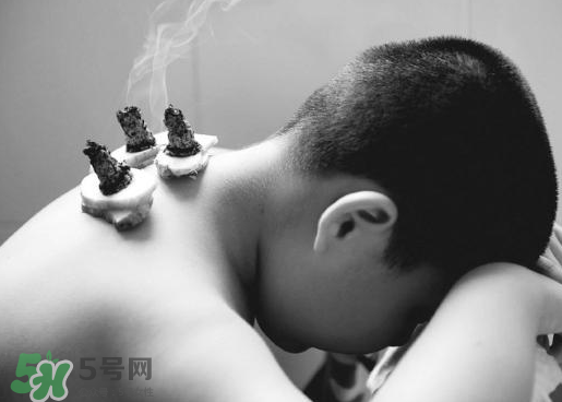 三伏灸什么人不能做？三伏灸適合哪些人？