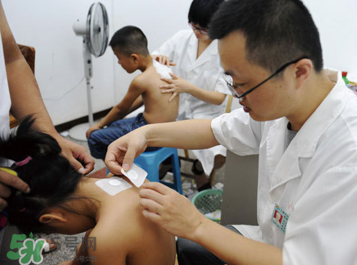 三伏灸什么人不能做？三伏灸適合哪些人？