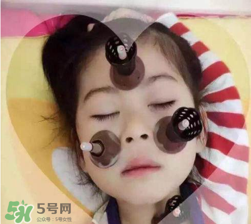 艾灸貼可以治咳嗽嗎？艾灸貼可以治退燒嗎？