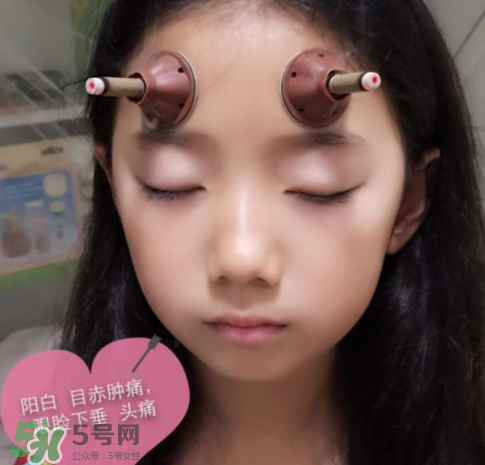 艾灸貼可以治咳嗽嗎？艾灸貼可以治退燒嗎？