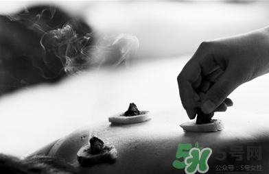 三伏灸什么時候開始灸？三伏灸怎么灸？