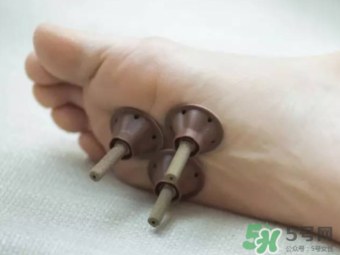 艾艾貼灸出水珠為什么？艾艾貼后有水珠要擦嗎？