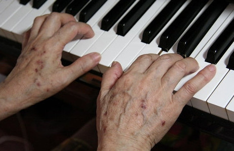 為什么人老了會(huì)長老年斑？老年斑是什么原因引起的