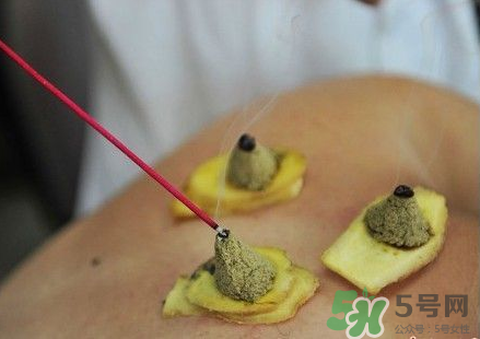 三伏灸可以自己灸嗎？三伏灸可以在家做嗎？